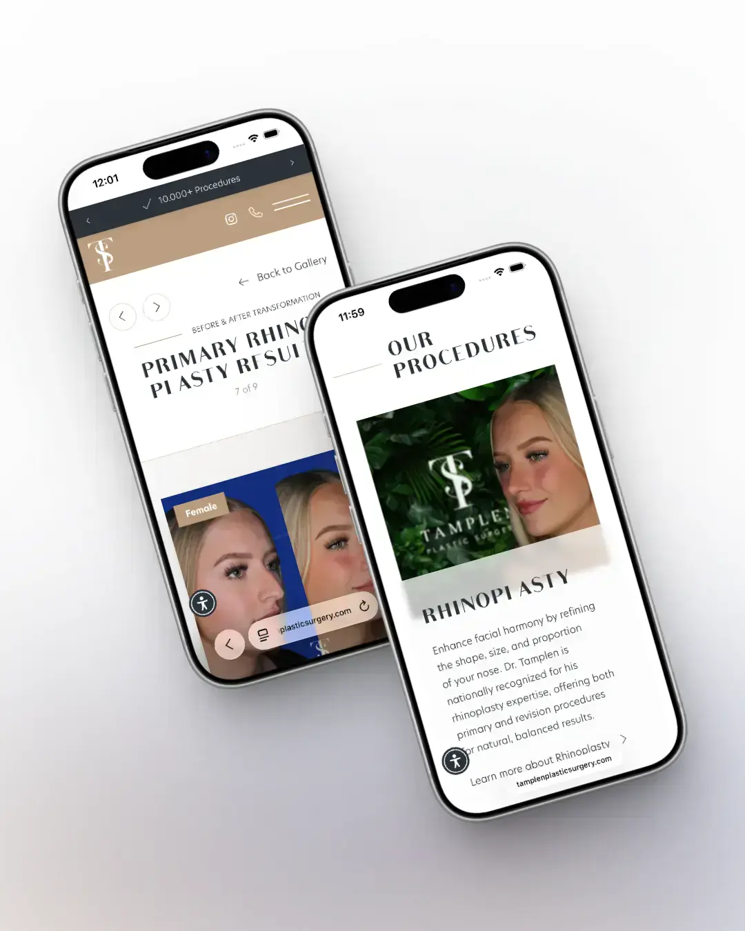 Tamplen Plastic Surgery - Mobile Procedures and Before and After Details